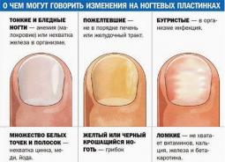 Если трескаются ногти на ногах ли руках: причины, лечение, ремонт
