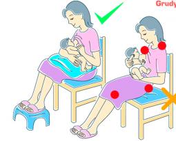 Симптоми та лікування лактостазу у матері-годувальниці в домашніх умовах Як виглядає лактостаз у матері-годувальниці
